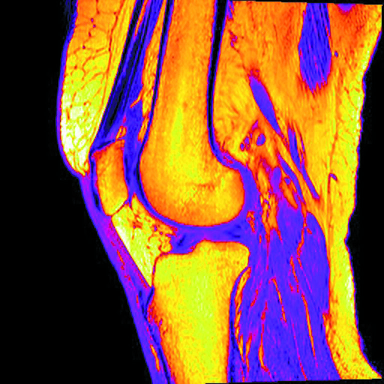 T2 magnetic resonance of a knee considered from an artistic perspective in "The Beauty of Imaging”