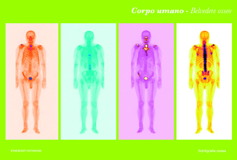 Postcard of  Corpo umano, belvedere osseo, bone scan considered from an artistic perspective in "The Beauty of Imaging", 2017