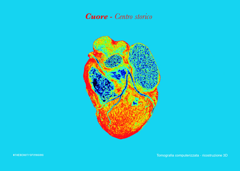 Postcard, Cuore, Centro storico, 3D CT reconstruction considered from an artistic perspective in "The Beauty of Imaging", 2017