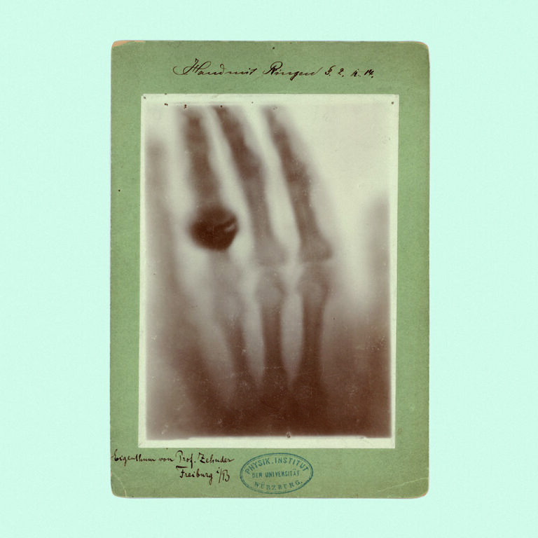 Radiograph of Berthe Röntgen’s hand, 1895