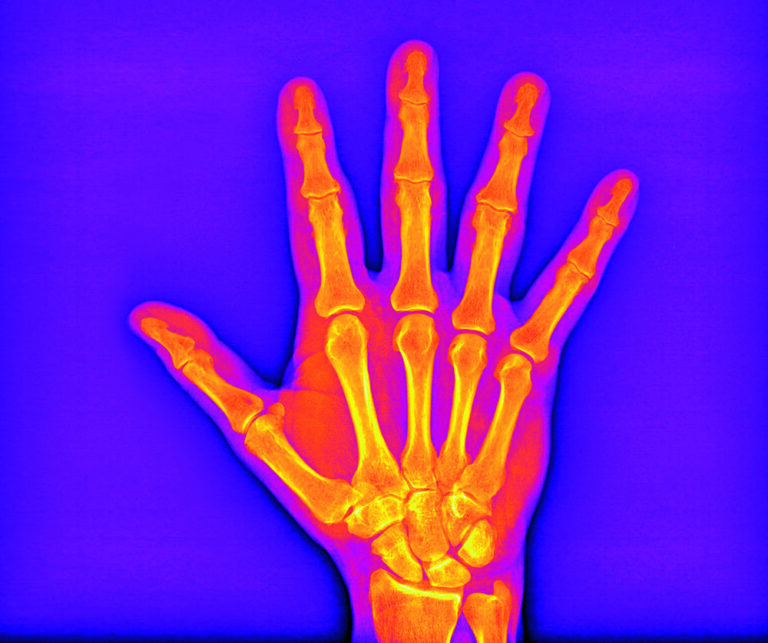 Radiograph of a hand considered from an artistic perspective in "The Beauty of Imaging”