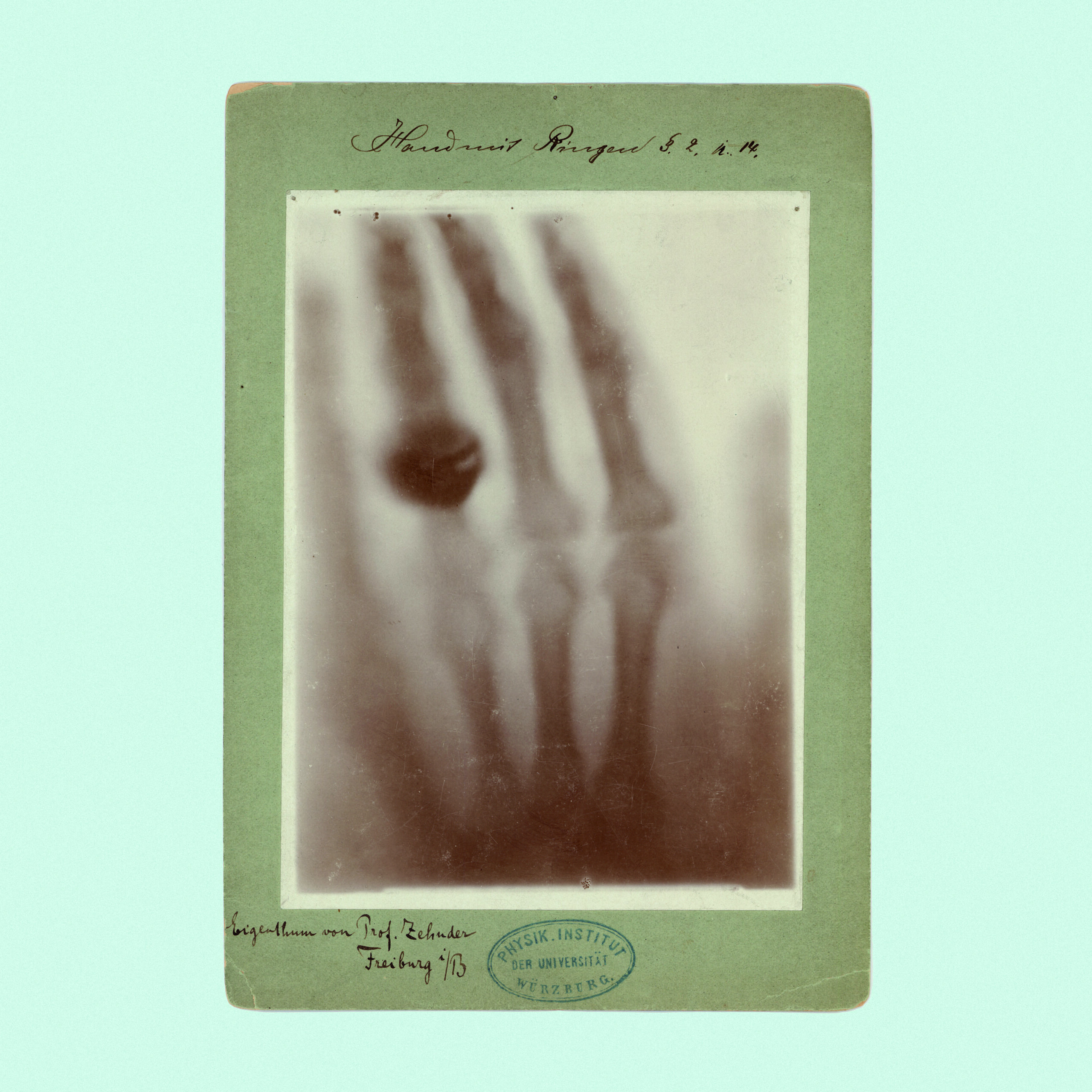 La prima radiografia della storia: la mano di Bertha Roentgen, moglie di Wilhelm Roentgen