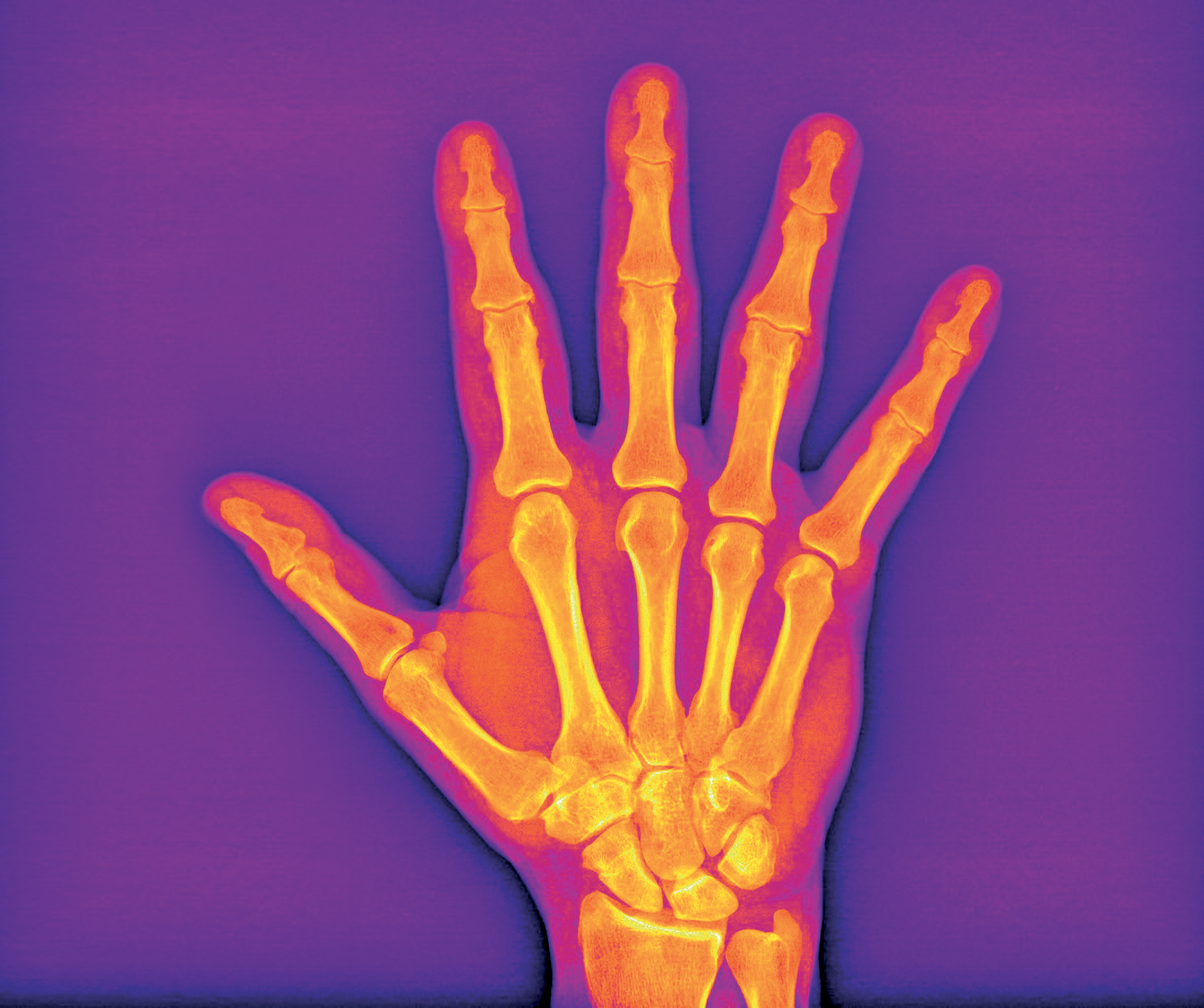 Artistic reinterpretation of an X-ray of a hand, The beauty of imaging 2017